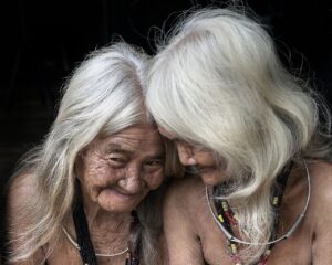医療脱毛は白髪にも効果があるのか？